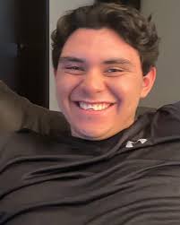 Nick broke some teeth playing basketball this weekend … by Sunday afternoon  he was put back together like nothing ever happened!! @dentalmedicgroup we  are so thankful and lucky to have such a