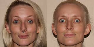 Aesthetic Revolution Las Vegas