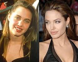 Celebrities Now And Then Luufy Angelina Jolie Nose Job Angelina Jolie Plastic Surgery Celebrity Plastic Surgery