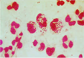 Image result for Neisseriaceae