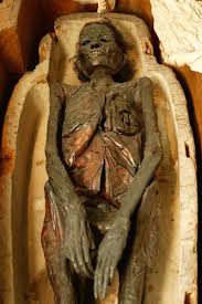 What scientists believe, Myrtis (dated age 11), may have looked like. Her remains were found in a mᴀss grave in #Athens, #Greece during the mid-1990s. She is believed to have died from