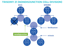 Types Of Down Syndrome Central Mississippi Down Syndrome Society