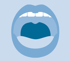 Bei der mandelentzündung (tonsillitis) die akute mandelentzündung (tonsillitis acuta, angina tonsillaris) ist meist eine bakteriell verursachte plötzlich einsetzende entzündung der gaumenmandeln. Operative Therapie Bei Schlafapnoe Somnolab