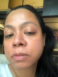 Any oily skin care routine recommendations?