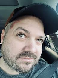 Now that I hit my head, am I not supposed to see the future or become a  genius?