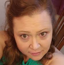 Where to find free or donated crutches for someone with a broken leg in  Foley?