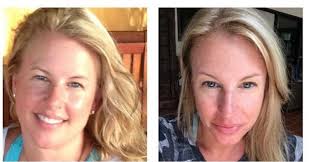 Before keto. After keto. Keto since 10/16 & will eat keto for life and long  term health. Less puffy. Less inflammation. -17 lbs. #Keto #ketogenic  #lowcarb #primal #paleo #whole30 #ketofam #ketotransformations #ketonewbie #