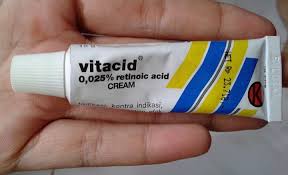 Stretch mark pada umumnya tidak menyakitkan atau membahayakan kesehatan seseorang yang mengalaminya, hanya saja stretch mark cenderung menimbulkan rasa tidak nyaman karena akan mengganggu penampilan. 8 Tips Untuk Menghilangkan Stretch Mark Dengan Cepat