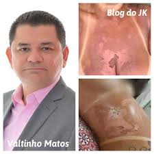 Blog do JK
