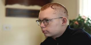 Mansfield Senior High freshman home for Christmas after brain surgery