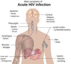 Symptome Einer Akuten Hiv Infektion Doccheck