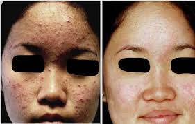 Alice — VILLANI MEDICAL