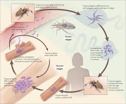 Chagas Disease Nejm