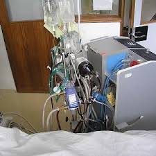 Putting a patient on ecmo can both take the strain off their damaged lungs, and because you have to artificially thin people's blood to put them on. Ecmo For Adult Respiratory Failure 2017 Update Healthmanagement Org
