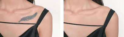 A tc kit consists of 2 parts: How To Cover Up A Tattoo Using Makeup Authoritytattoo