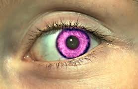 We did not find results for: Central Heterochromia Two Different Eye Colors Causes And Types