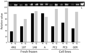 significant discrepancies in dna quantification by nanodrop