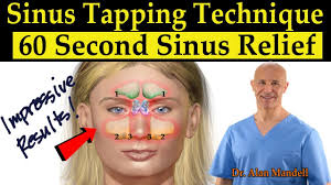 Is it causing you much trouble? Dr Mandell S Sinus Tapping Technique 60 Second Sinus Drainage Relief Headaches Tinnitus Youtube
