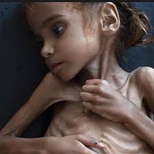 Fundraiser by Ivana Lucía Jelenszky : YEMEN: Niños al borde de la muerte