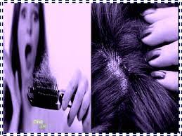 وصفات طبيعيه لصحة الشعر الشعر يمثل شيئا هاما للمرأة على وجه الخصوص وايضا البعض من الرجال وهو مرآة natural hair recipes hair food natural hair styles