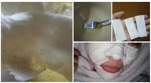 Cara menghilangkan komedo hitam di hidung secara alami. Cara Buang Whitehead Blackhead Yang Teramat Degil Mudahnya Bahan Pun Murah