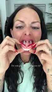 Discover Denttach Gold for Secure Denture Adhesion