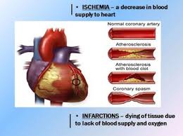 Blood flows from high to low pressure. Cardiovascular System Unit Circulatory System Unit Human Body Systems