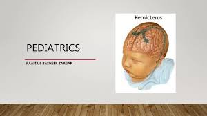 Image result for Kernicterus