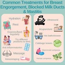 Common Treatments for Breast Engorgement, Blocked Milk Ducts & Mastitis