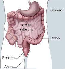 Diarrhea, constipation, or feeling that the bowel does not empty all the way. Rectal Cancer Symptoms Causes Treatment Dr Nikhil Agrawal
