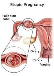 Pin On Midwifery