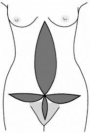 What is the symbolism of a fleur de lis? Fleur De Lys Abdominoplasty A Consecutive Case Series British Journal Of Plastic Surgery