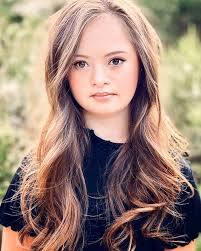 CHRISTMAS BAUBLE🎄 A five-year-old boy with Down's Syndrome has launched a  successful career in modeling after he posed as a bauble in the new  Sainsbury's Christmas advert. Frankie Porter made his first