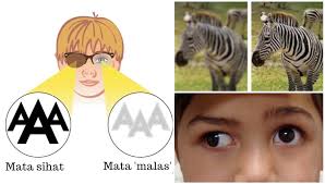 We did not find results for: Mata Malas Lazy Eye Pada Kanak Kanak Simptom Punca Rawatan