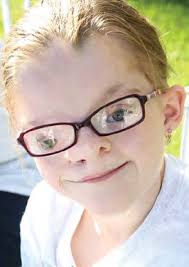 thankful for crouzon syndrome