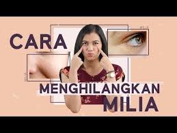 Begini Cara Menghilangkan Dan Mengatasi Milia Pada Wajah Youtube Wajah Bintik Bintik Berat Badan
