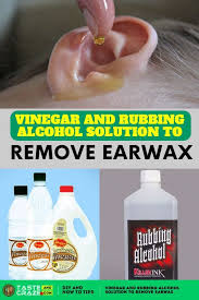 Vinegar And Rubbing Alcohol Solution To Remove Earwax In 2020 Ear Wax Rubbing Alcohol Alcohol