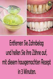 Entfernen Sie Zahnbelag Und Hellen Sie Ihre Zahne Auf Mit Diesem Hausgemachten Rezept In 3 Minuten In 2020 Hausgemachtes Rezept Zahnbelag Zahnstein Entfernen