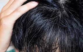 While gray hair lacks pigmentation, it is still healthy hair that will respond to common haircare products and routines. How To Reverse Your Premature Grey Hair With Ayurveda Vedix