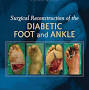 Profile Picture of Surgical Reconstruction of the Diabetic Foot and Ankleon Google