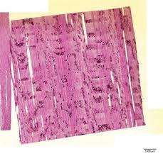 Image result for Diospyros gabunensis