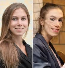 Concerns about Meret Schneider's health and political views