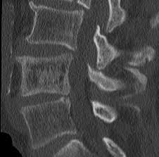 Find vectors of picture frame. Radiology Quiz 62021 Radiopaedia Org
