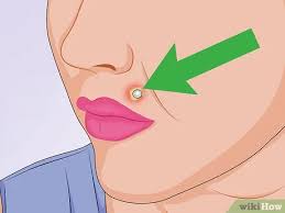 Most piercers consider the snake eyes piercing to be unsafe. Erkennen Ob Ein Piercing Entzundet Ist Wikihow