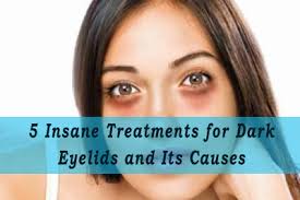 Another popular addition to the dark eyelids remedies list is elevating your head while sleeping. 5 Insane Treatments To Get Rid Of Dark Eyelids And Its Causes Lighten Skin Dry Eyelids Eyelid Lift