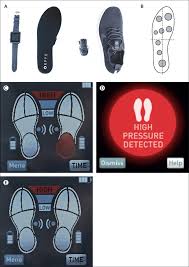Innovative Intelligent Insole System Reduces Diabetic Foot Ulcer Recurrence At Plantar Sites A Prospective Randomised Proof Of Concept Study The Lancet Digital Health