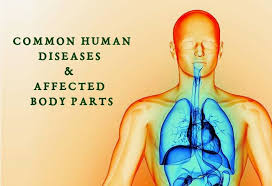 The part of the body at the bottom of the leg on which a person stands: Common Human Disease Affected Body Parts Psc Arivukal
