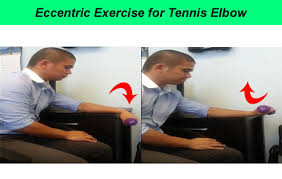If needed, where a brace while you do this exercise. Top 10 Most Effective Exercises For Tennis Elbow In 2020