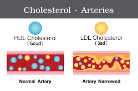 This good cholesterol takes extra cholesterol in your blood back to your liver so your body can get rid of it. Cholesterol Good Vs Bad Cardiology Avita Health System