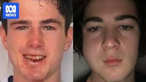 Parolee sentenced over jaw-breaking punch, but will the decision echo  outside country footy?